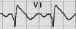 An ECG snippet - #1